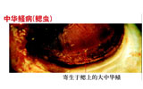 中华鳋病